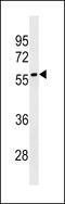 Leucine Rich Repeat Containing 69 antibody, 60-342, ProSci, Western Blot image 