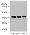 Aspartate Beta-Hydroxylase Domain Containing 2 antibody, orb354003, Biorbyt, Western Blot image 