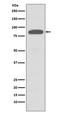 Component Of Inhibitor Of Nuclear Factor Kappa B Kinase Complex antibody, M01918, Boster Biological Technology, Western Blot image 