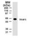 TNF Receptor Associated Factor 5 antibody, ALX-804-250-C100, Enzo Life Sciences, Western Blot image 