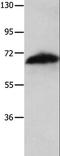 Apoptosis Inducing Factor Mitochondria Associated 1 antibody, LS-C403807, Lifespan Biosciences, Western Blot image 