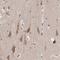 Inverted Formin, FH2 And WH2 Domain Containing antibody, PA5-51447, Invitrogen Antibodies, Immunohistochemistry frozen image 