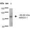 Adhesion Molecule With Ig Like Domain 1 antibody, 56530, QED Bioscience, Western Blot image 