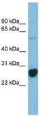 Ribosomal Protein L10a antibody, TA345127, Origene, Western Blot image 