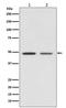 Vitamin D Receptor antibody, M00210, Boster Biological Technology, Western Blot image 