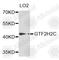 GTF2H2 Family Member C, Copy 2 antibody, A5239, ABclonal Technology, Western Blot image 