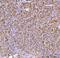 Interleukin 34 antibody, A06903-3, Boster Biological Technology, Immunohistochemistry paraffin image 