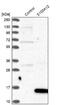 S100 Calcium Binding Protein A12 antibody, NBP1-86694, Novus Biologicals, Western Blot image 