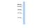 Dual Serine/Threonine And Tyrosine Protein Kinase antibody, A11737, Boster Biological Technology, Western Blot image 