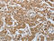 Proteasome 26S Subunit, Non-ATPase 6 antibody, CSB-PA643972, Cusabio, Immunohistochemistry frozen image 