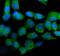 Isocitrate Dehydrogenase (NADP(+)) 2, Mitochondrial antibody, M00510-2, Boster Biological Technology, Immunofluorescence image 