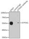 ATP Synthase F1 Subunit Alpha antibody, GTX33028, GeneTex, Immunoprecipitation image 