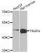 TNF Receptor Associated Factor 4 antibody, LS-C346204, Lifespan Biosciences, Western Blot image 