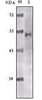 Lysine Acetyltransferase 5 antibody, STJ98422, St John