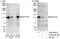 Notch Receptor 2 antibody, A302-084A, Bethyl Labs, Western Blot image 