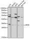 Apolipoprotein E antibody, GTX64352, GeneTex, Western Blot image 