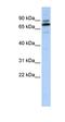 NOP9 Nucleolar Protein antibody, orb324944, Biorbyt, Western Blot image 