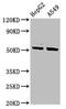 Keratin 16 antibody, CSB-PA012515LA01HU, Cusabio, Western Blot image 