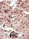 Phosphorylase Kinase Catalytic Subunit Gamma 1 antibody, abx033249, Abbexa, Immunohistochemistry paraffin image 