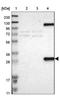 CD63 Molecule antibody, NBP1-82784, Novus Biologicals, Western Blot image 
