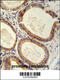 Translocation Associated Membrane Protein 2 antibody, 62-128, ProSci, Immunohistochemistry paraffin image 