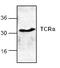 Pre T Cell Antigen Receptor Alpha antibody, TA319112, Origene, Western Blot image 