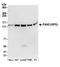 PAB-dependent poly(A)-specific ribonuclease subunit 2 antibody, A304-882A, Bethyl Labs, Western Blot image 