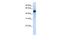 TRNA Methyltransferase 2 Homolog B antibody, GTX46163, GeneTex, Western Blot image 