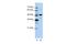 Nucleolar Protein 4 antibody, A12520, Boster Biological Technology, Western Blot image 