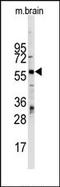 Zinc Finger And BTB Domain Containing 7B antibody, AP13457PU-N, Origene, Western Blot image 