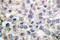 Catenin Alpha 1 antibody, LS-C175943, Lifespan Biosciences, Immunohistochemistry paraffin image 