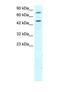 Regulator Of G Protein Signaling 9 antibody, PA1-24417, Invitrogen Antibodies, Western Blot image 