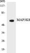 Mitogen-Activated Protein Kinase Kinase Kinase 8 antibody, LS-C292161, Lifespan Biosciences, Western Blot image 