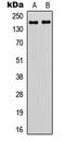 Zinc Finger Protein 608 antibody, LS-C356172, Lifespan Biosciences, Western Blot image 