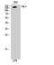 Kinase Insert Domain Receptor antibody, A00901, Boster Biological Technology, Western Blot image 