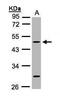 Keratin 20 antibody, PA5-27250, Invitrogen Antibodies, Western Blot image 