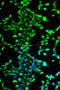 Annexin A2 antibody, STJ22619, St John