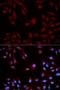 Signal Transducer And Activator Of Transcription 5B antibody, LS-C330891, Lifespan Biosciences, Immunofluorescence image 