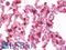 LCK Proto-Oncogene, Src Family Tyrosine Kinase antibody, 42-990, ProSci, Western Blot image 