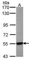 Cytochrome P450 Family 26 Subfamily B Member 1 antibody, PA5-28159, Invitrogen Antibodies, Western Blot image 