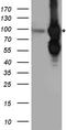 B-Raf Proto-Oncogene, Serine/Threonine Kinase antibody, LS-C796616, Lifespan Biosciences, Western Blot image 