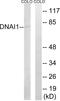 Dynein Axonemal Intermediate Chain 1 antibody, A07656, Boster Biological Technology, Western Blot image 