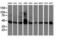 Adipocyte Plasma Membrane Associated Protein antibody, NBP2-01716, Novus Biologicals, Western Blot image 