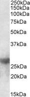 Galectin 3 antibody, STJ72518, St John