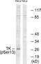 Thymidine Kinase 1 antibody, P04850, Boster Biological Technology, Western Blot image 