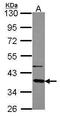 G Protein Subunit Alpha Transducin 2 antibody, TA308890, Origene, Western Blot image 