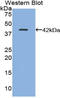 TFF1 antibody, LS-C296792, Lifespan Biosciences, Western Blot image 