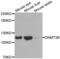 DNA Methyltransferase 3 Beta antibody, abx002130, Abbexa, Western Blot image 