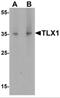 T Cell Leukemia Homeobox 1 antibody, NBP2-81887, Novus Biologicals, Western Blot image 