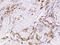 S100 Calcium Binding Protein A8 antibody, GTX02042, GeneTex, Immunohistochemistry paraffin image 